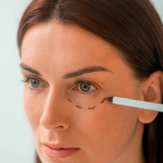 Blefaroplastia: estética ou necessidade médica?